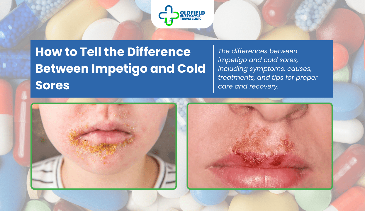 How to Tell the Difference Between Impetigo and Cold Sores