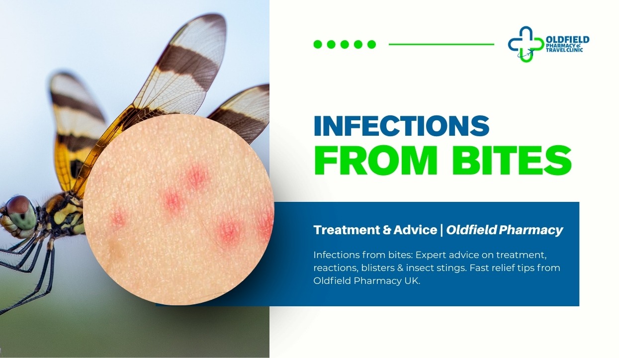 Infections from Bites: Treatment & Advice | Oldfield Pharmacy